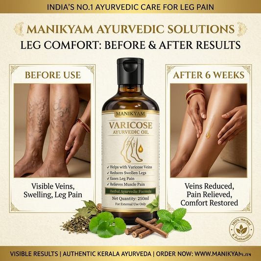 VARICOSE VEINS PAIN RELIEF OIL - Ayurveda Oil Relief 60 Days Challenge
